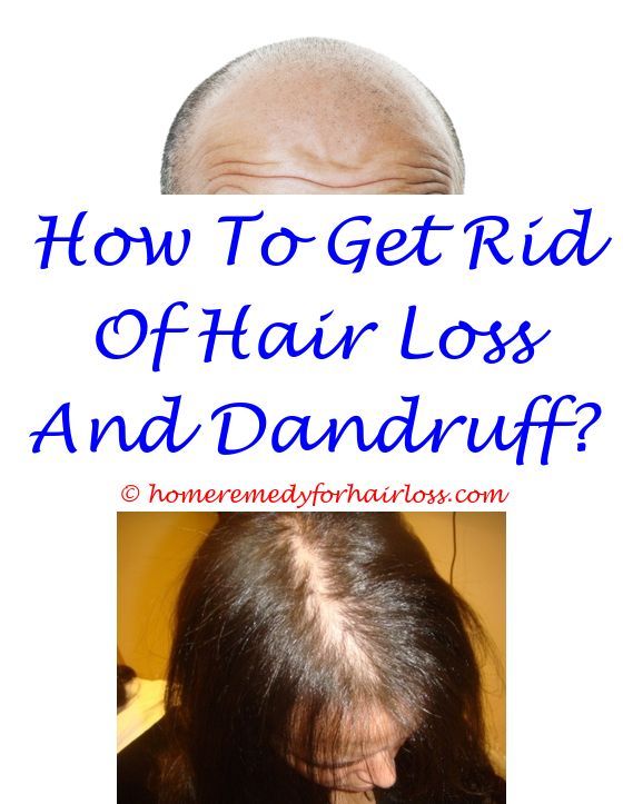 how long does hair loss last after stress