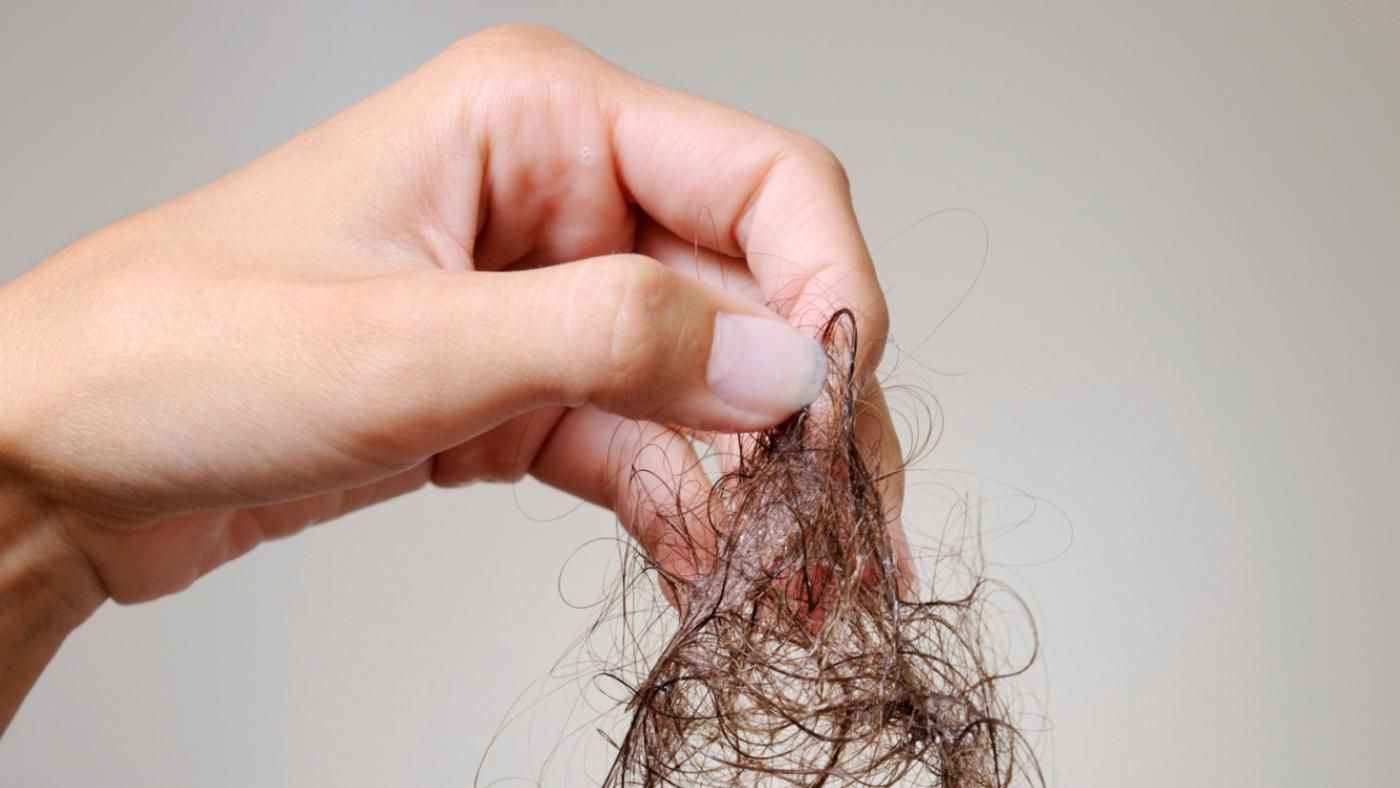How Much Hair Loss Is Normal for Women?