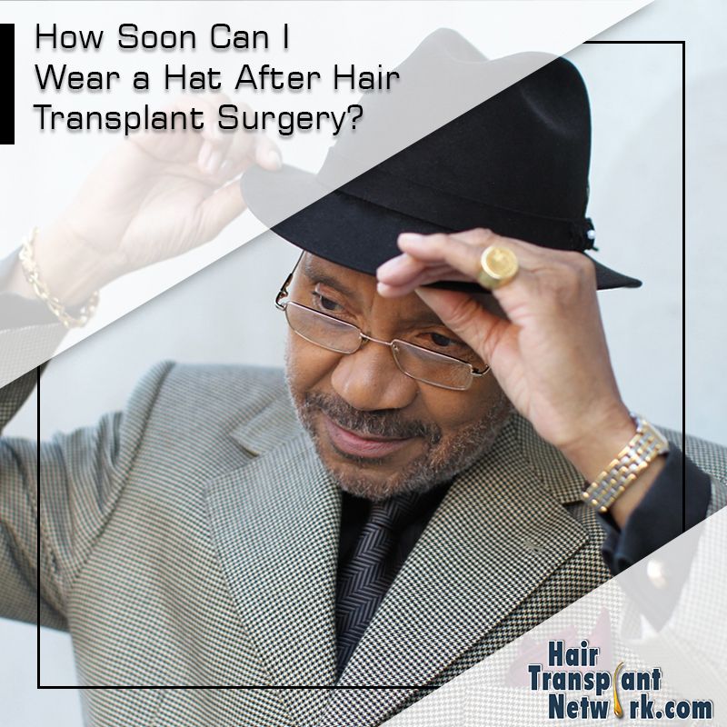 How Soon Can I Wear a Hat After Hair Transplant Surgery?