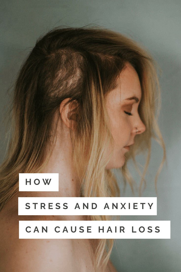 How Stress and Anxiety Can Cause Hair Loss