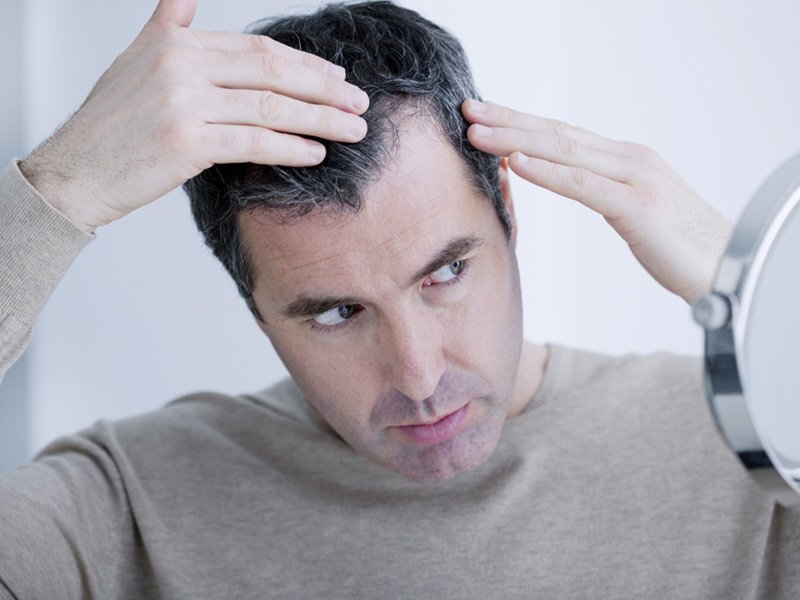 How Thyroid Disease Can Cause Hair Loss