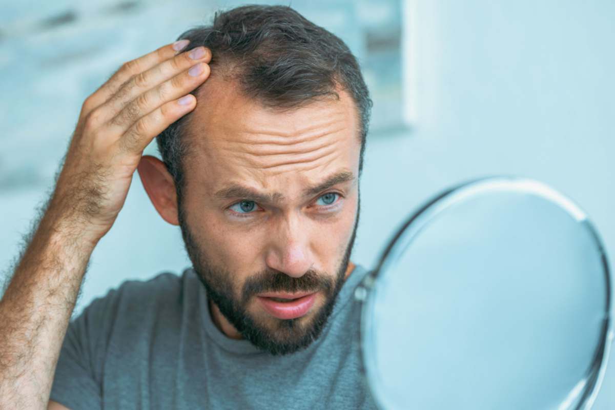 How To Deal With Thinning Hair