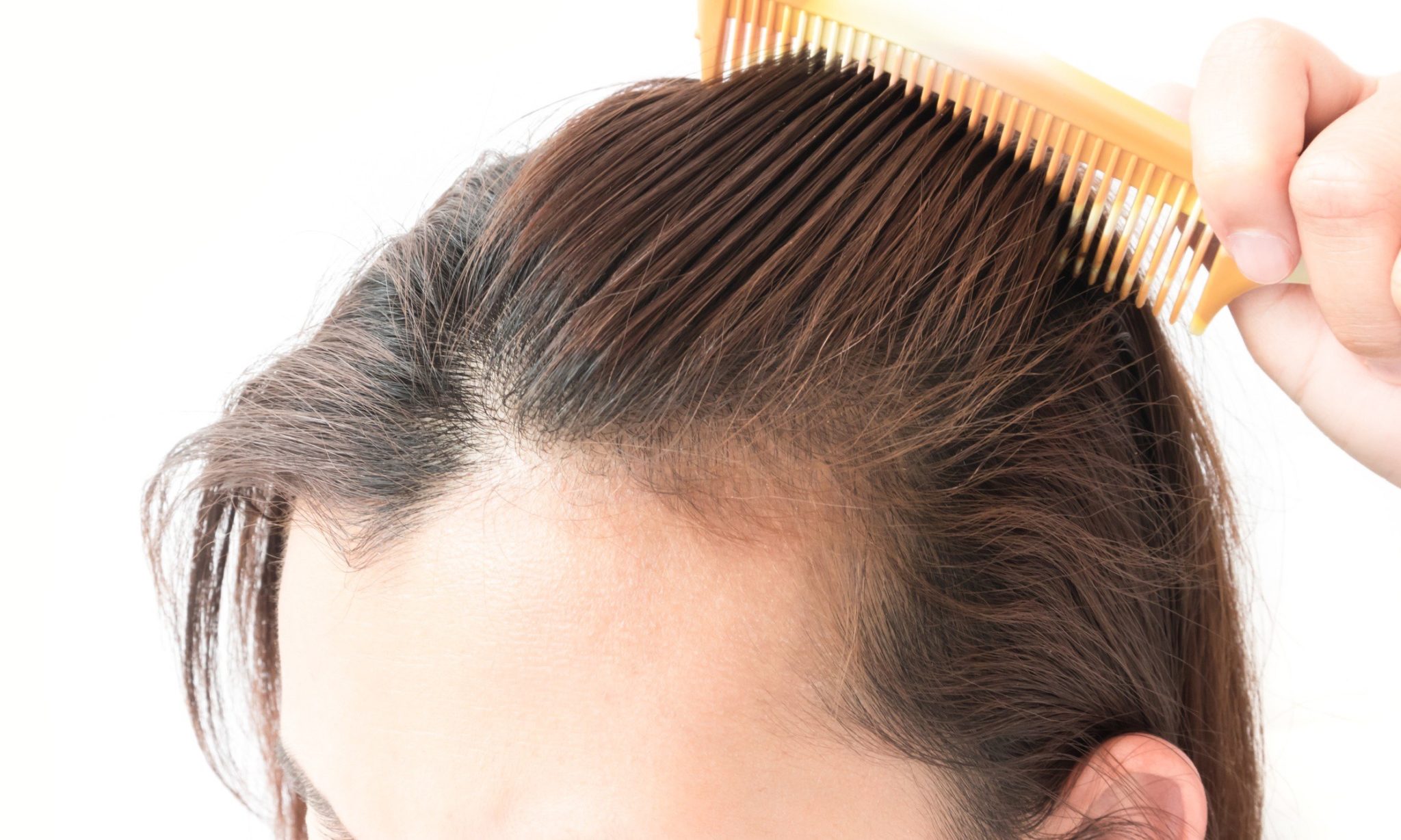 How to Determine Effectiveness of Shampoo Brands for Hair Loss ...