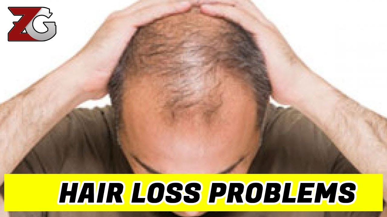 How to Fix Hair Loss 2020