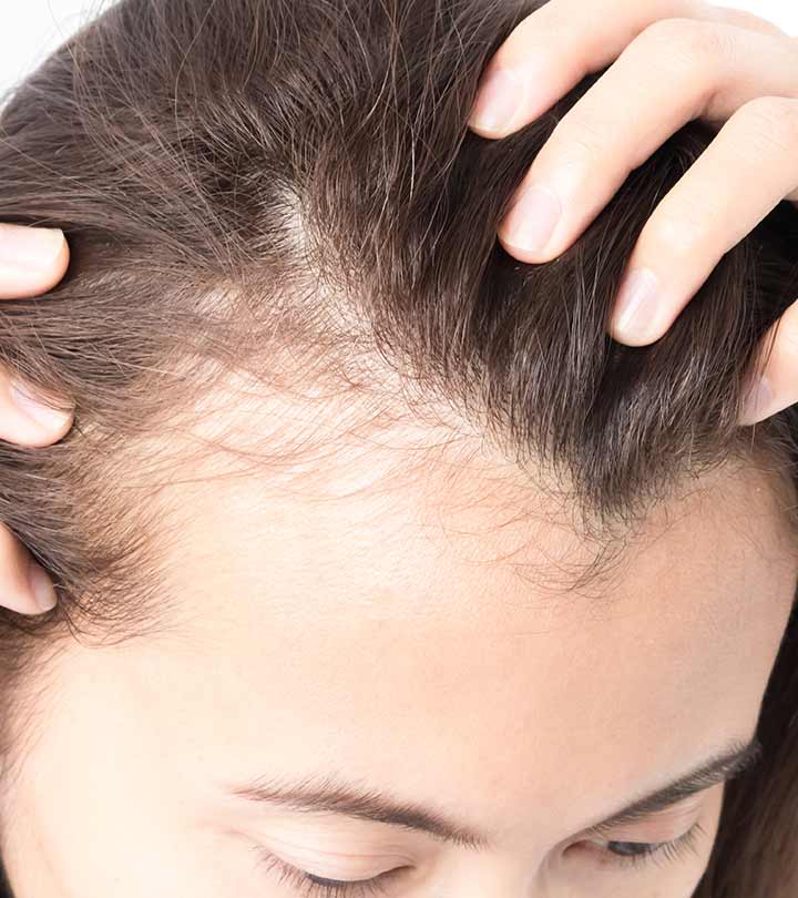 How to get rid of hair loss home remedies ...