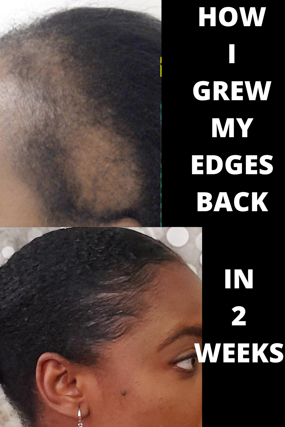 HOW TO GROW YOUR EDGES BACK IN 2 WEEKS