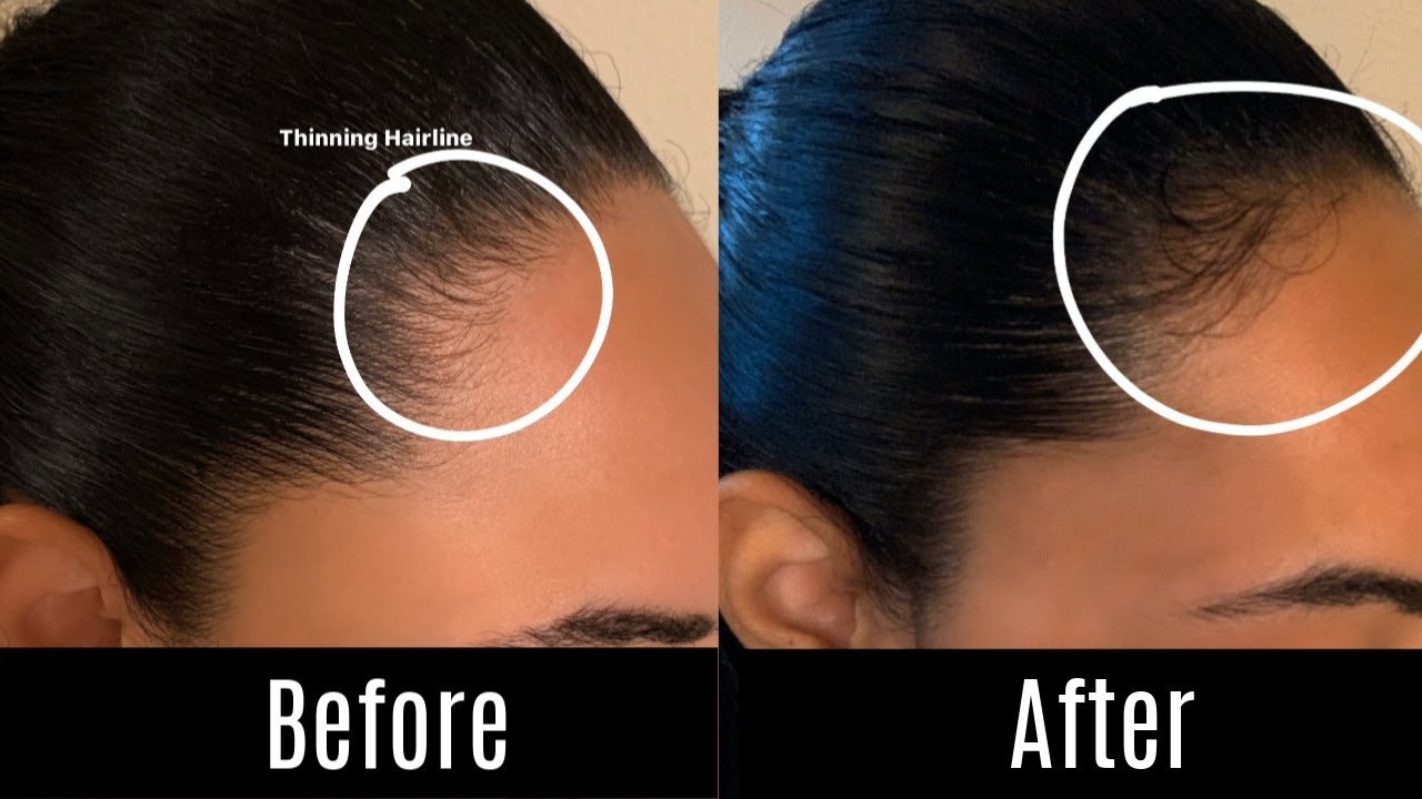 How To Grow Your Hair Back