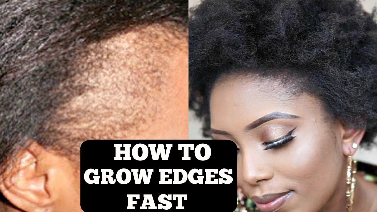 HOW TO GROW YOUR THIN/BALD EDGES IN 3 DAYS (GUARANTEED ...