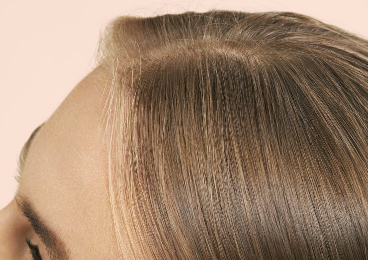 How to Help Combat Female Hair Loss