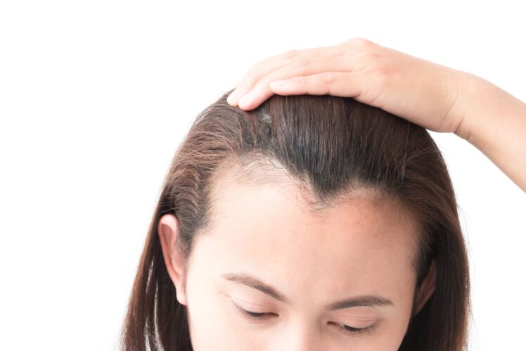How To Hide Thinning Hair In The Front Woman