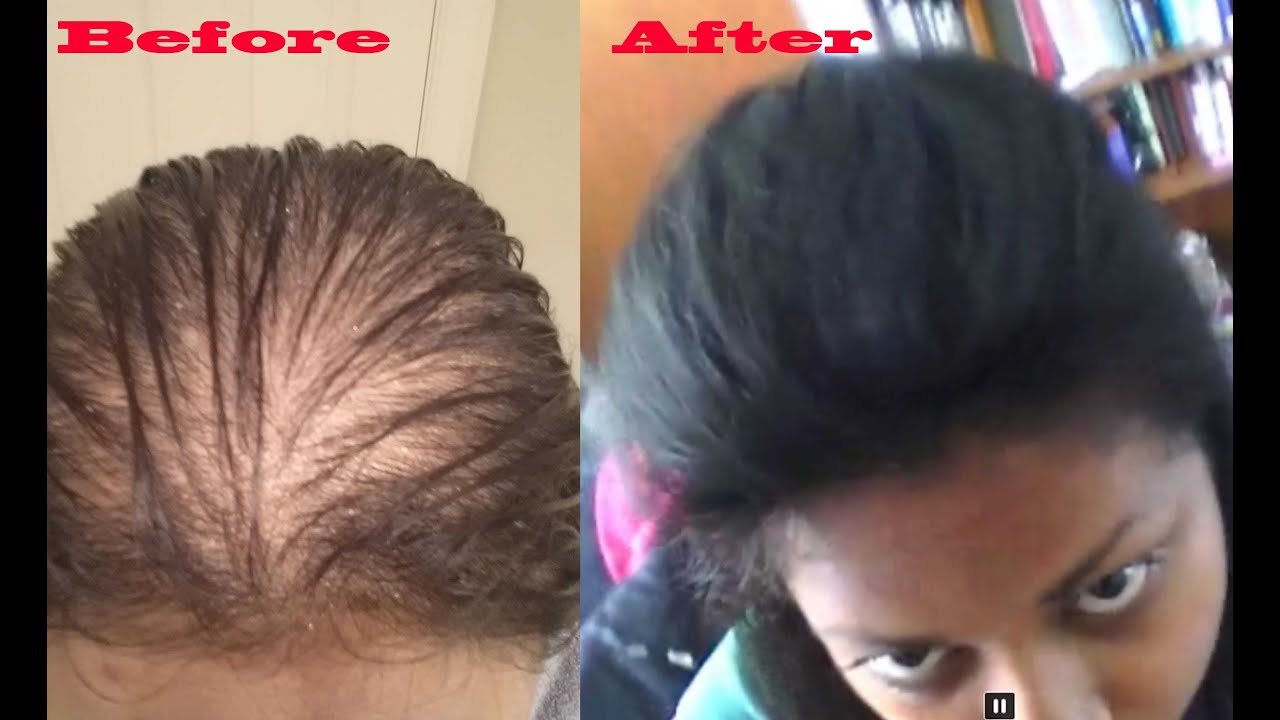 how to make thin hair look thicker using hair pieces