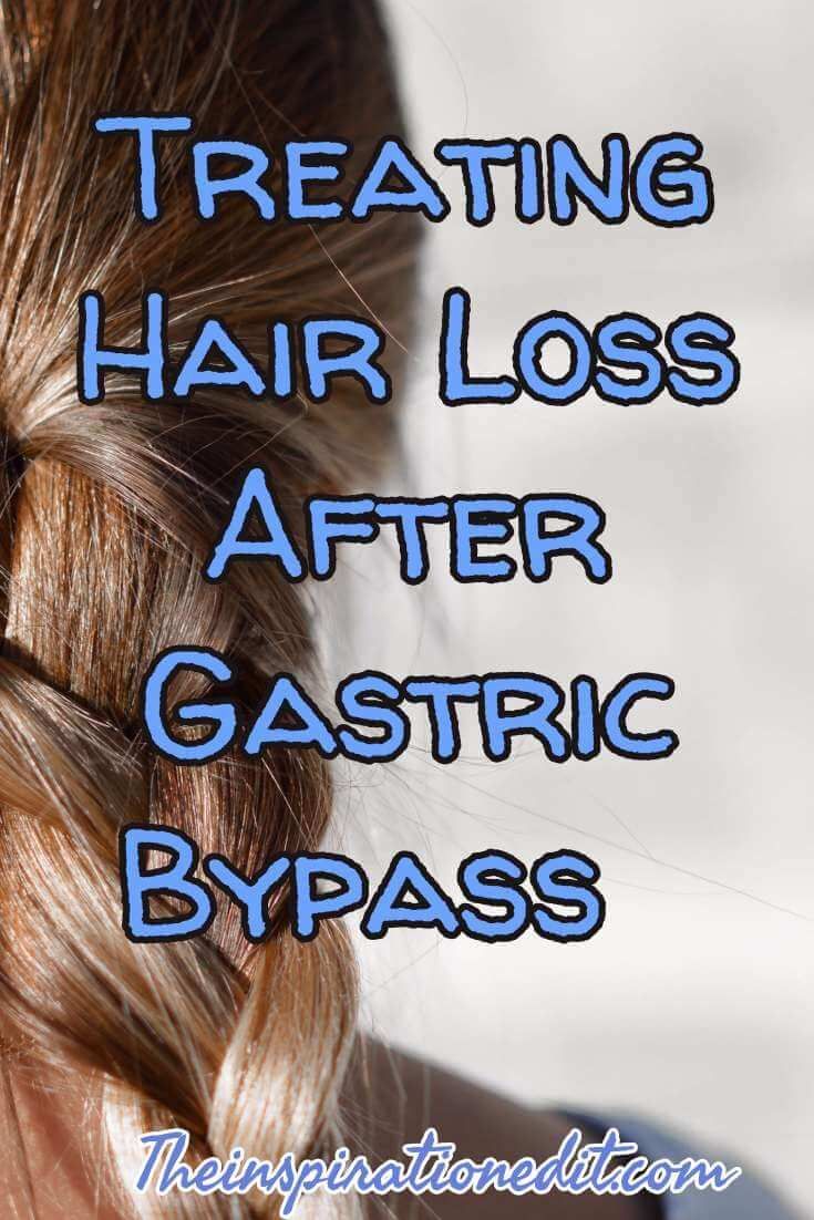 How to prevent hair loss after gastric sleeve surgery ...