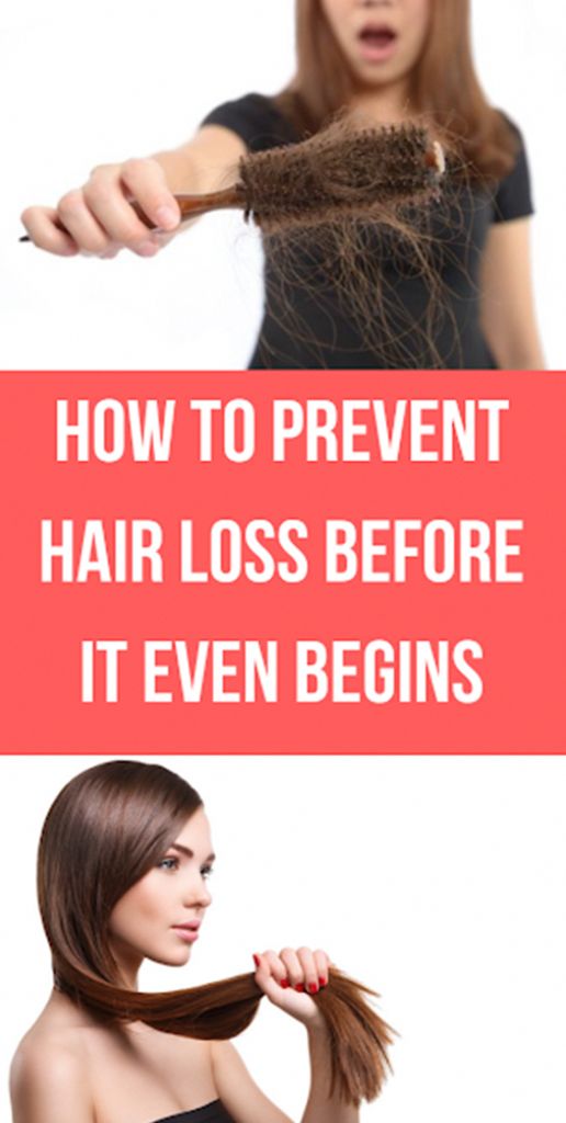 How to Prevent Hair Loss before It even Begins  Buzzhome World # ...