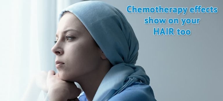 How to reduce hair loss after chemotherapy