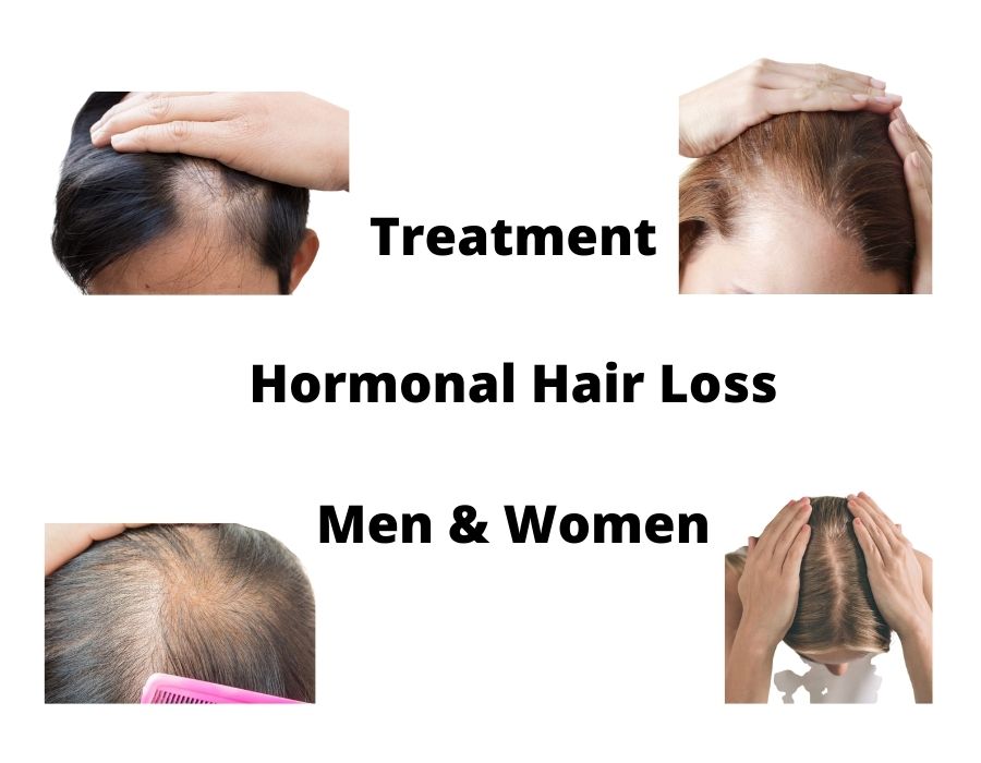 How to reverse Hormonal hair loss