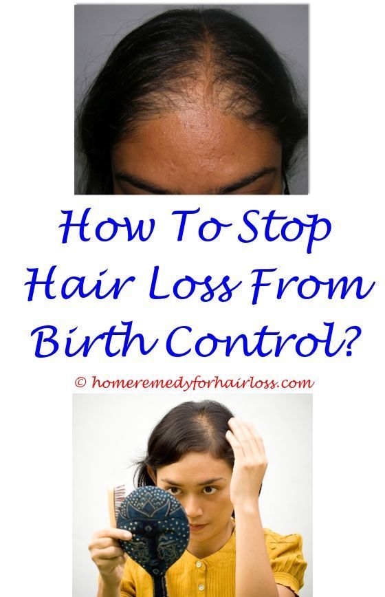 How To Stop Balding From Birth Control in 2020
