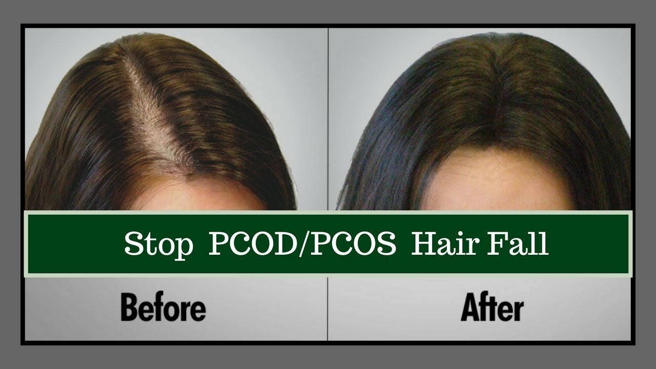 HOW TO STOP HAIR FALL NATURALLY