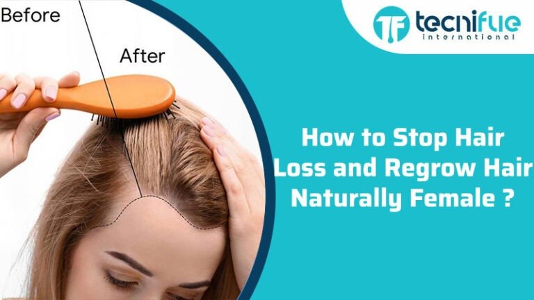 How To Stop Hair Loss And Regrow Hair Naturally » TecniFUE ...