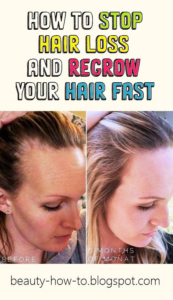 How to Stop Hair Loss and Regrow Your Hair Fast
