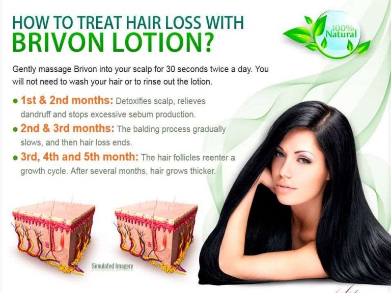 How to stop hair loss at any age by using brivon the natural loyion