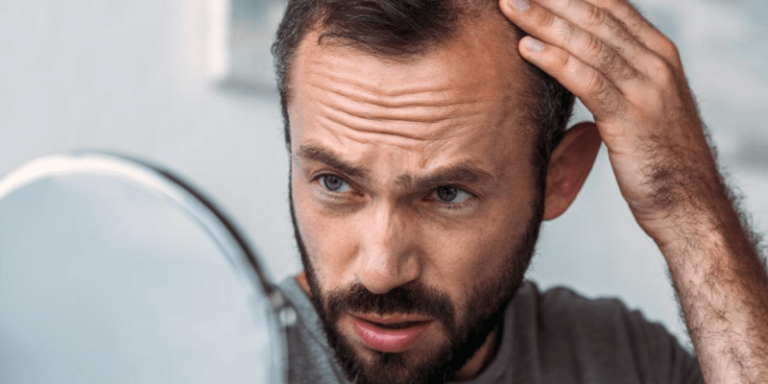 How to Stop Hair Loss Due to Hyperthyroidism?