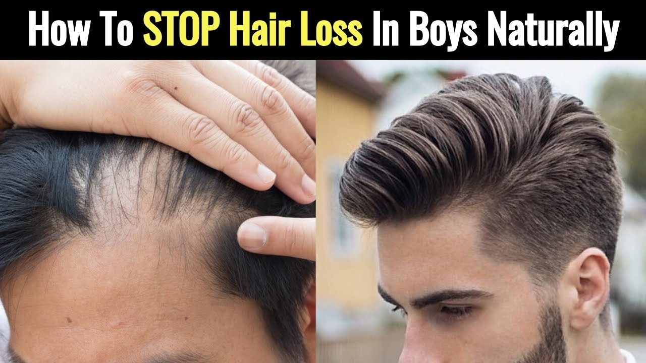 How To STOP Hair Loss In Teenage (Boys)