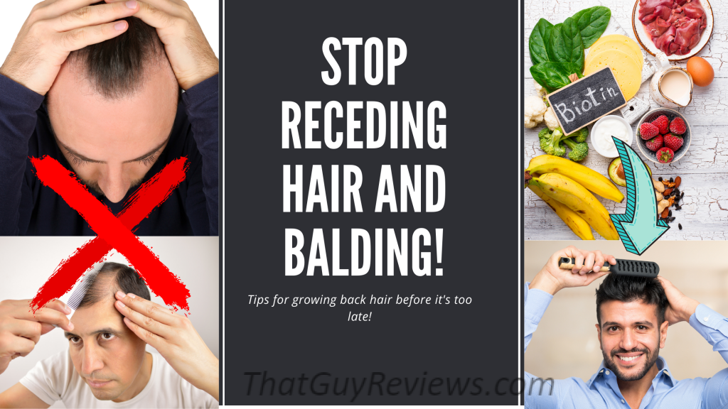 How to Stop Hair Loss, Receding Hairline and Balding  TGR