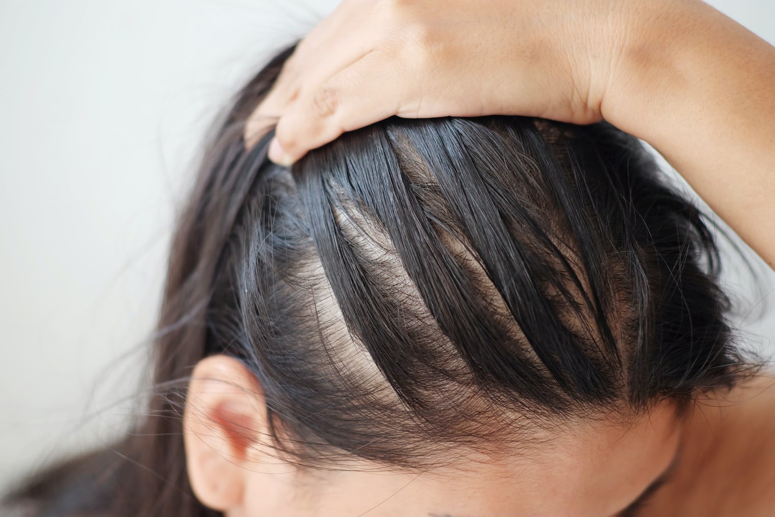 How To Tell If Your Hair Is Thinning &  7 Things That Can Help