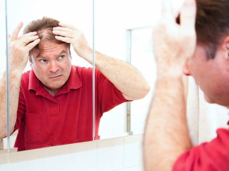 How to tell if youre losing too much hair and what to do