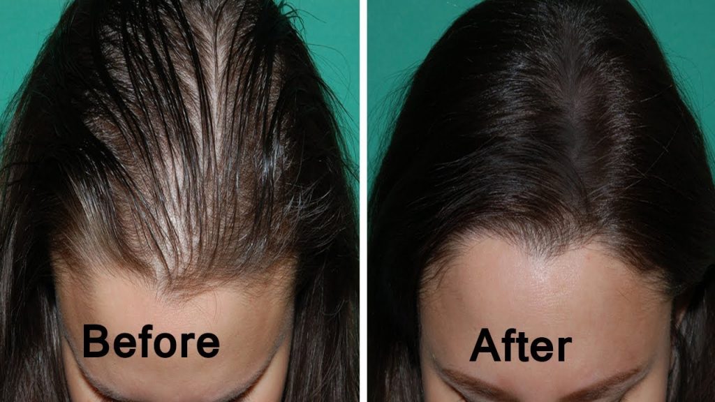 HOW TO THICKEN THIN HAIR NATURALLY?