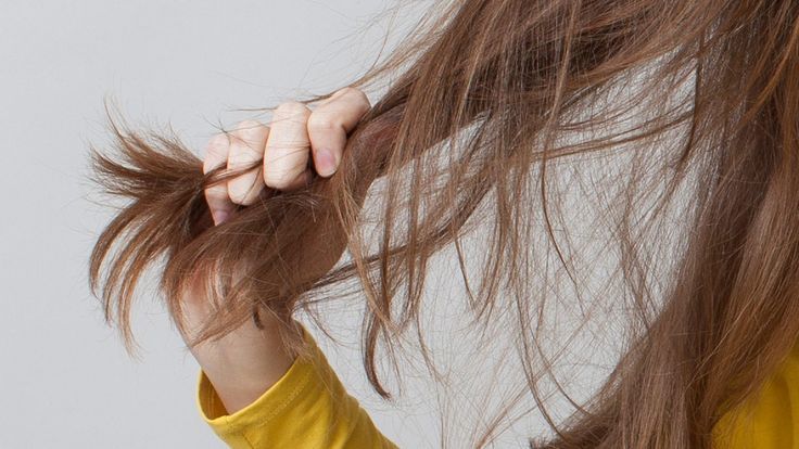 How to Treat Sudden Hair Loss in women from Stress, Most ...