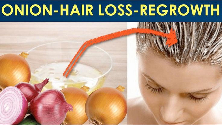 How to use Onion Juice to Stop Hair Loss and Promote Hair Regrowth ...