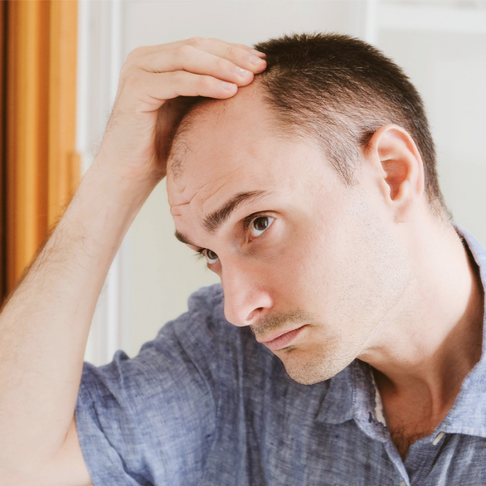 How Your Lifestyle May Be Causing Premature Hair Loss