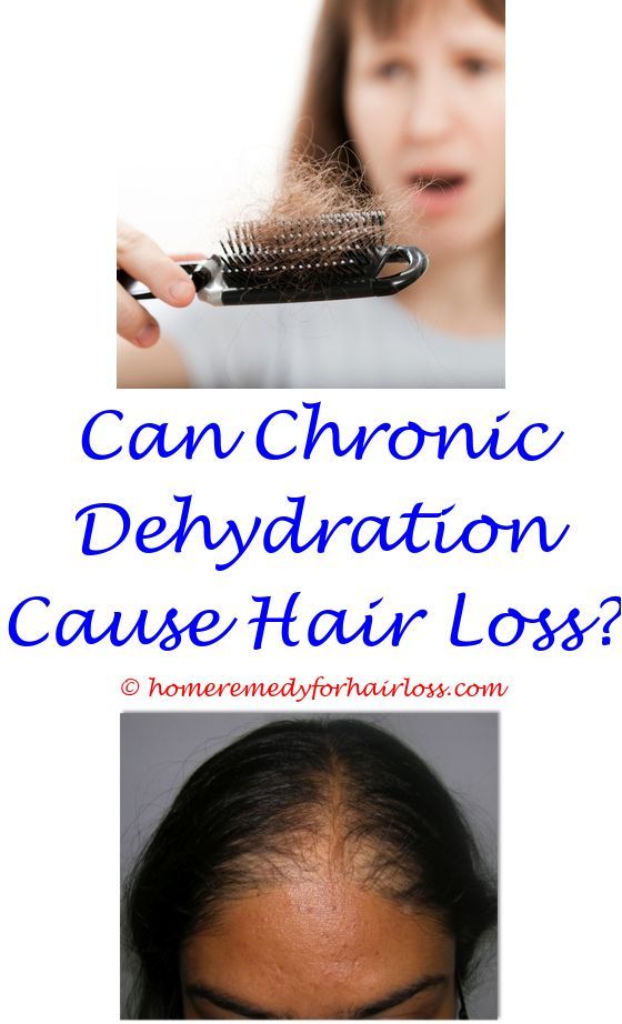 hyperthyroid symptoms and hair loss