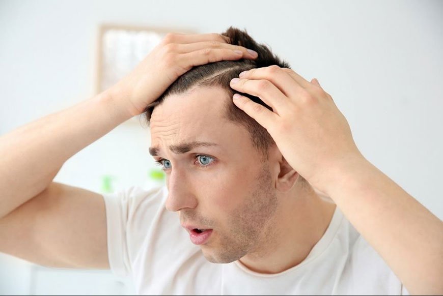 Hypothyroidism and hair loss: is it reversible? â Clinicana