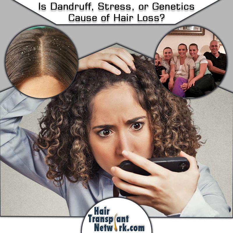 Is Dandruff, Stress, or Genetics the Cause of Hair Loss?