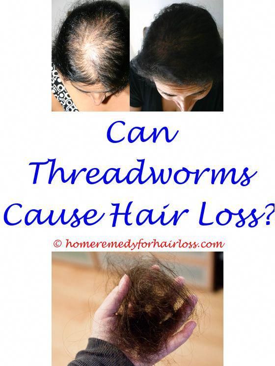 is hair greying and hair loss related