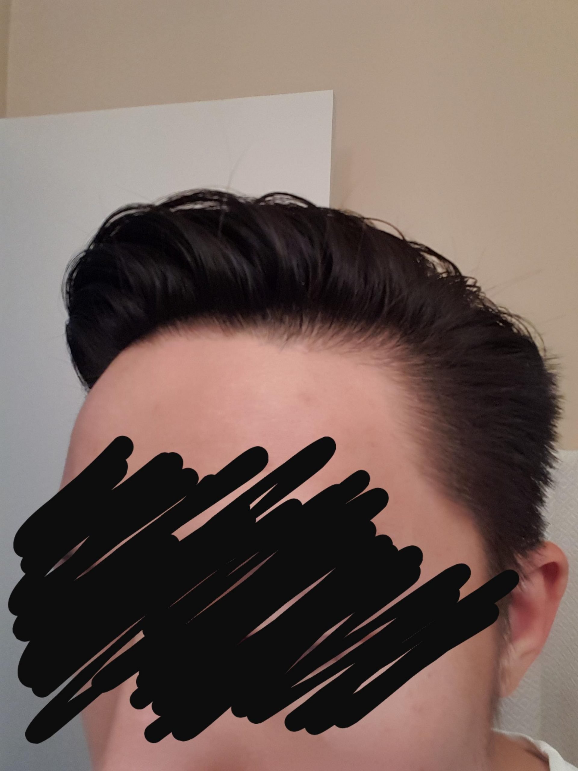 Is my hair thinning or do I just have fine hair ...