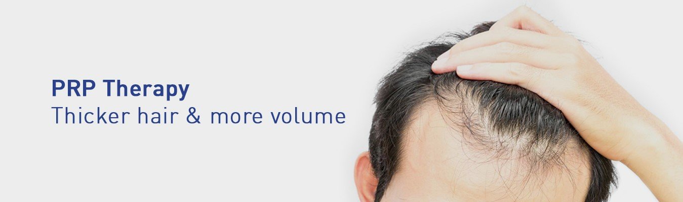 Is Platelet Rich Plasma Good for Hair Loss Treatment?  Advancells Group