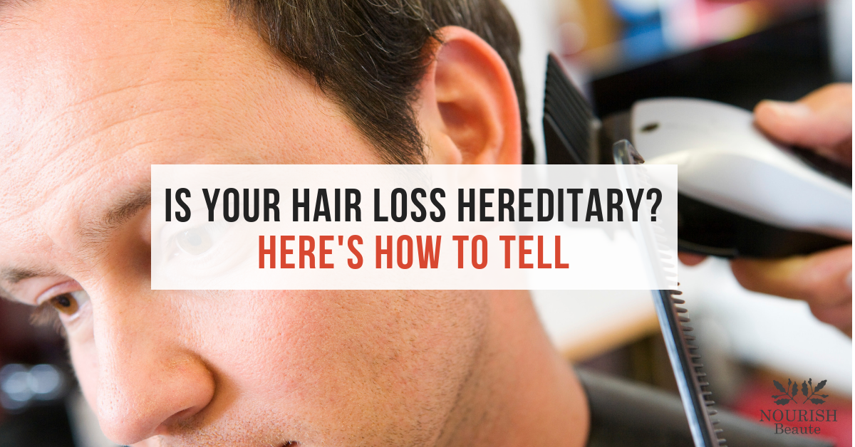 Is your Hair Loss Hereditary? How to tell. . . â Nourish ...