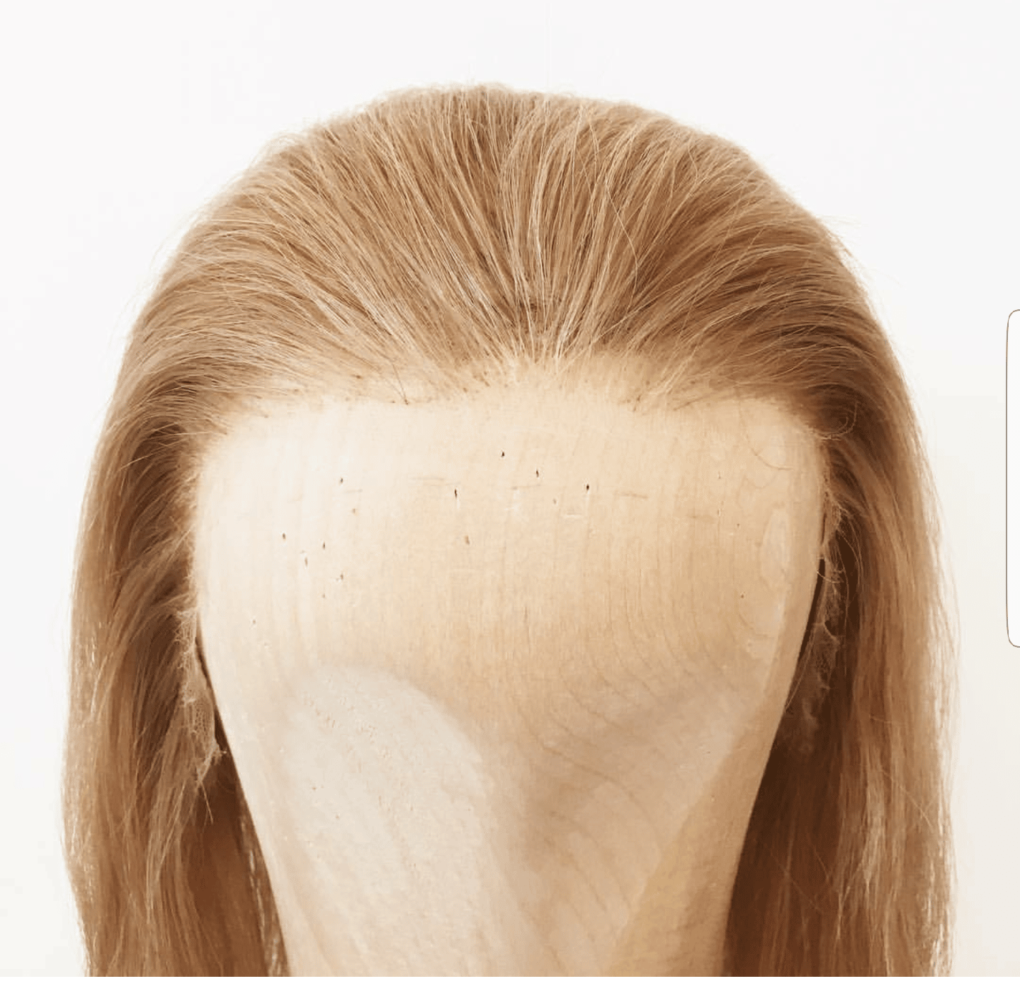Lace Frontal &  Hair Loss