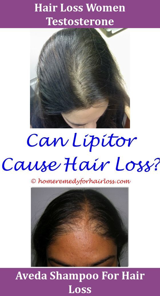 Lipitor And Hair Loss