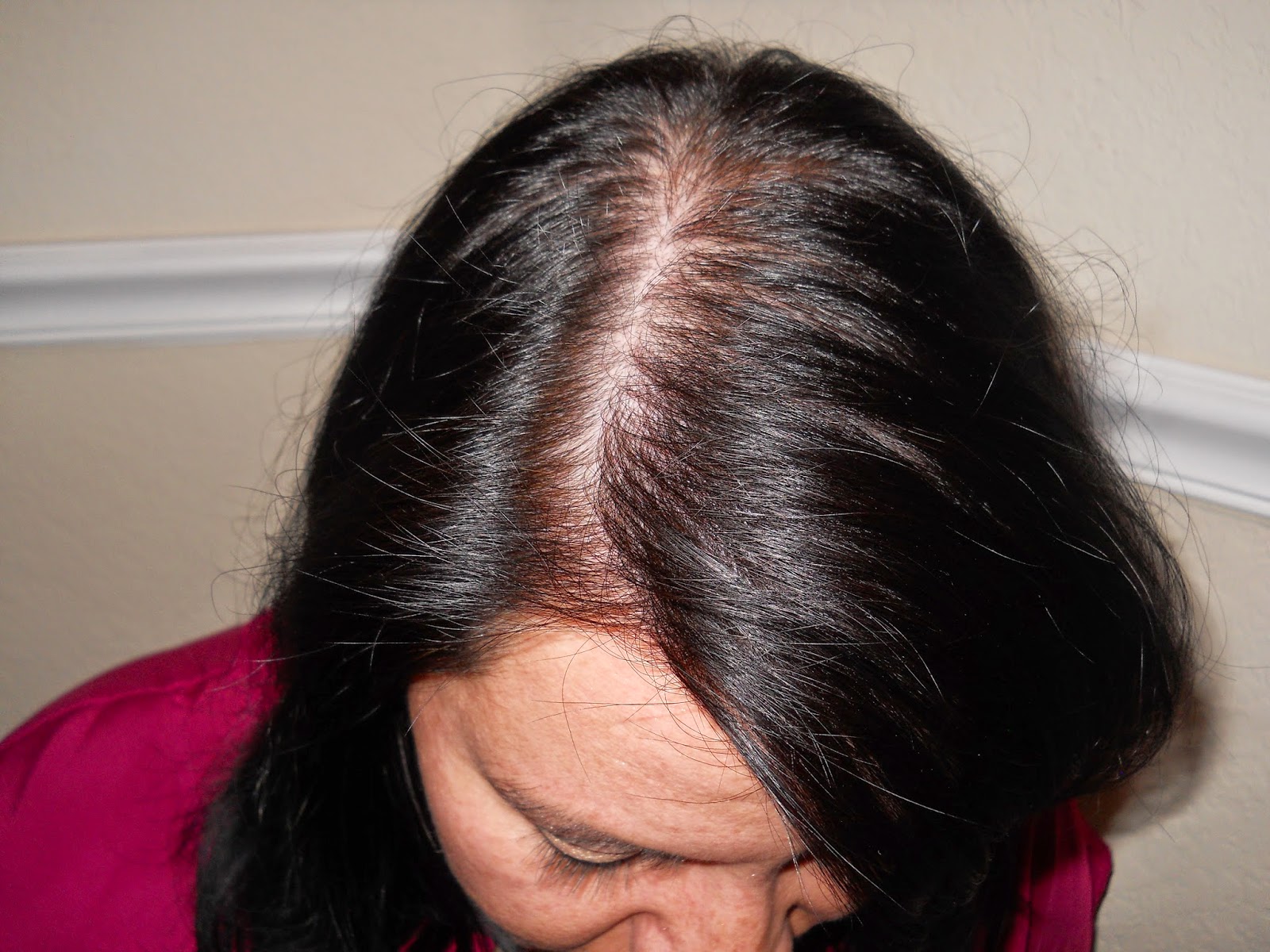Living with Thinning Hair: AKA " Fighting the Good Fight" 