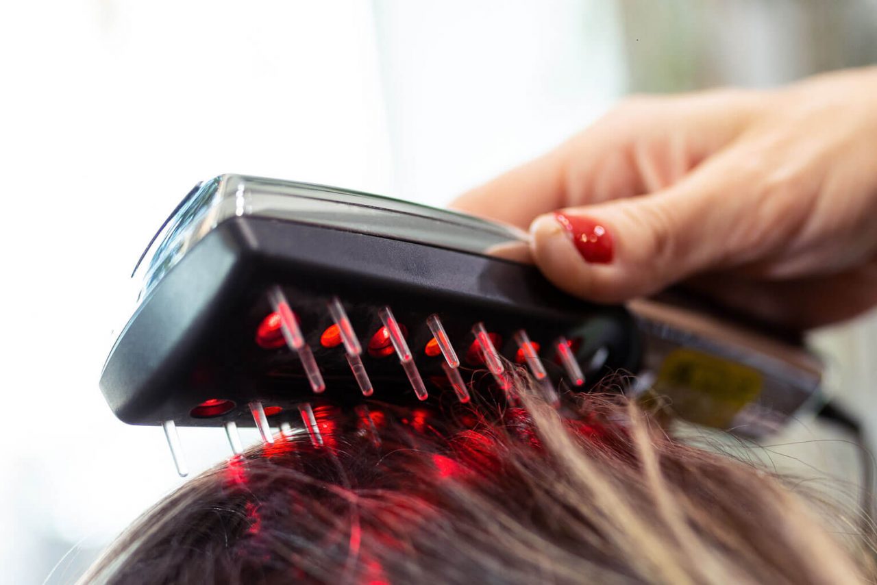 Low level laser therapy can reverse hair loss