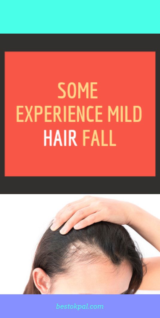 Lupus Hair Loss Scalp Click image for more details.