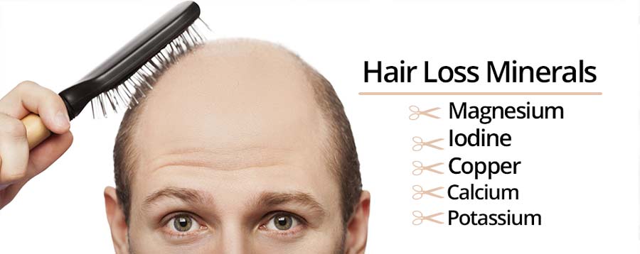 Magnesium, Iodine, Copper, Calcium &  Potassium Deficiency Hair Loss