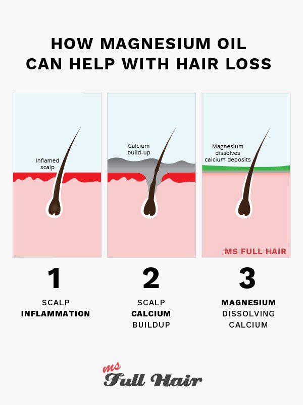 Magnesium Oil for Hair Loss