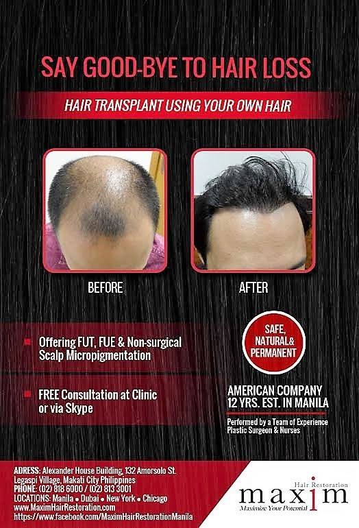 Manila Shopper: Hair Loss is Inevitable, But Theres a ...