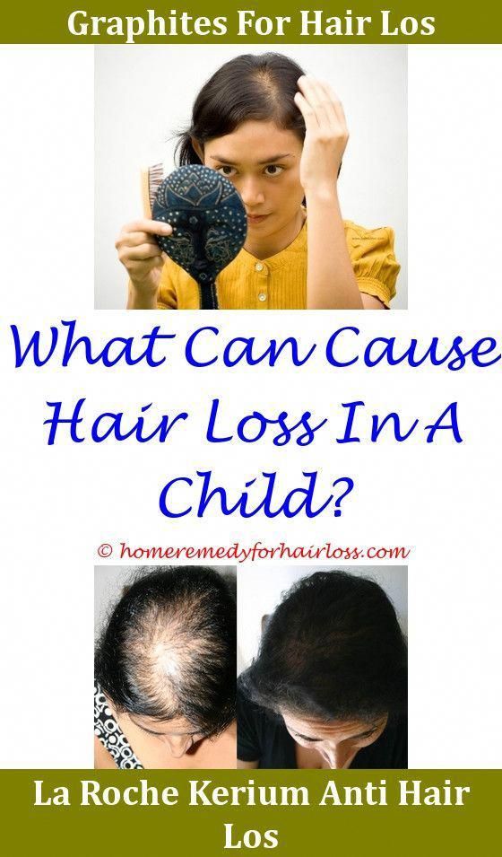 Men Hair Loss Doctor Near Me,Hair Loss does nuvaring cause ...