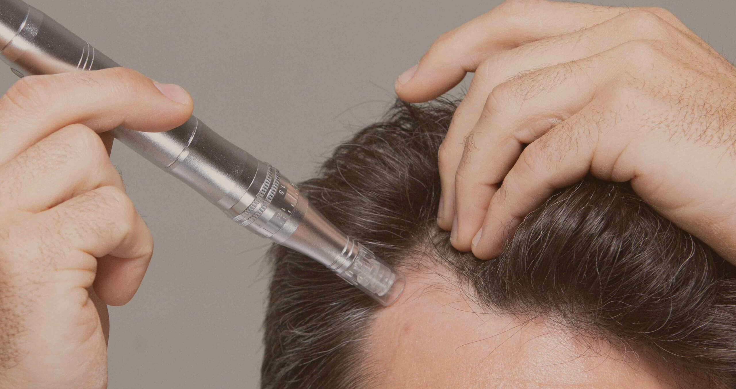 Microneedling for hair loss